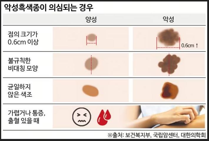 피부암