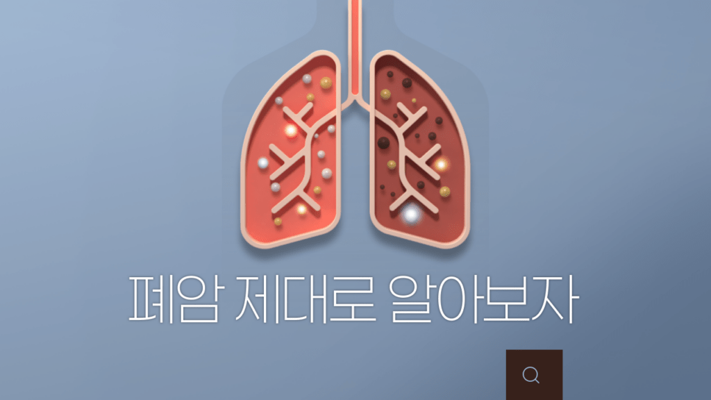 폐암검사